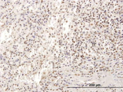 Immunohistochemistry (Formalin/PFA-fixed paraffin-embedded sections) - Anti-SP100 antibody (AB167605)