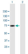Western blot - Anti-SP100 antibody (AB167605)