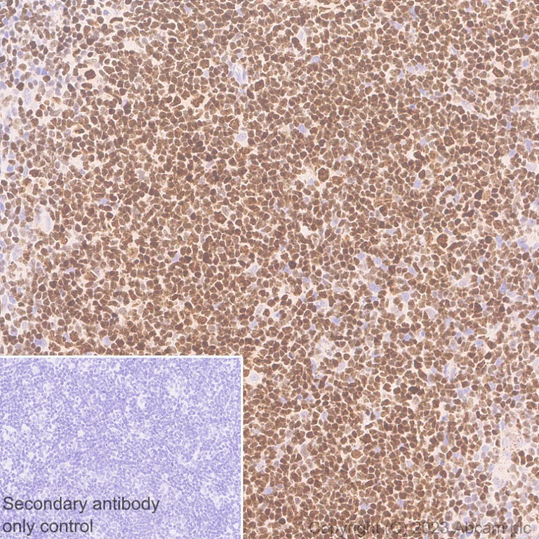 Immunohistochemistry (Formalin/PFA-fixed paraffin-embedded sections) - Anti-SP140 antibody [EPR25120-83] (AB314211)