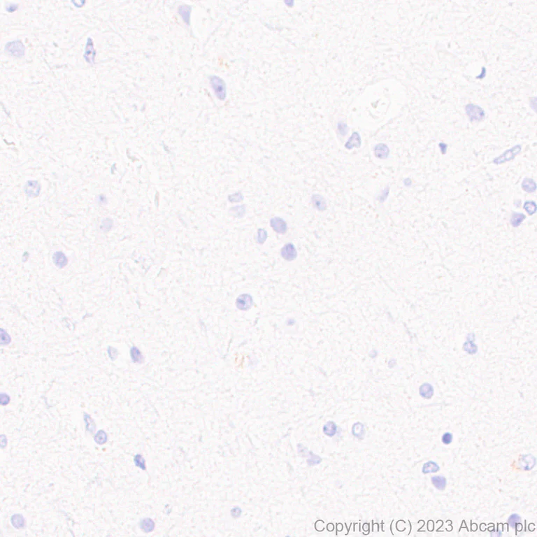 Immunohistochemistry (Formalin/PFA-fixed paraffin-embedded sections) - Anti-SP140 antibody [EPR25120-83] (AB314211)