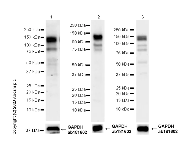 Western blot - Anti-SP140 antibody [EPR25120-83] (AB314211)