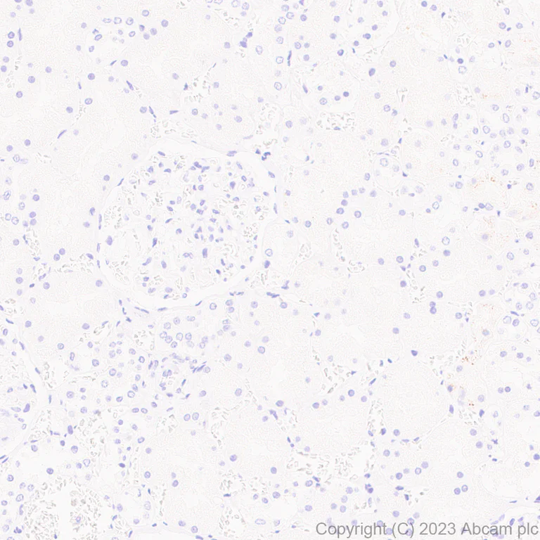 Immunohistochemistry (Formalin/PFA-fixed paraffin-embedded sections) - Anti-SP140 antibody [EPR25120-83] - BSA and Azide free (AB314212)
