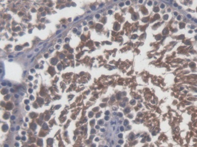 Immunohistochemistry (Formalin/PFA-fixed paraffin-embedded sections) - Anti-SP17 antibody (AB232826)