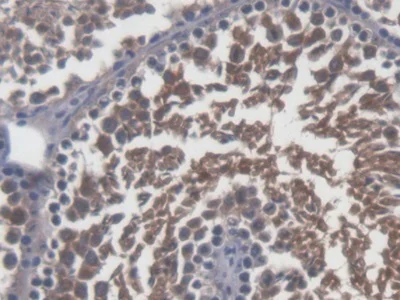 Immunohistochemistry (Formalin/PFA-fixed paraffin-embedded sections) - Anti-SP17 antibody (AB232826)