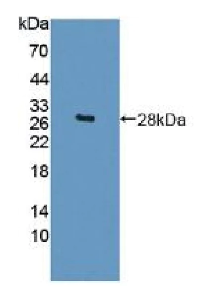 Western blot - Anti-SP17 antibody (AB232826)