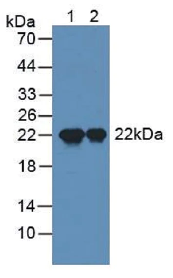 Western blot - Anti-SP17 antibody (AB232826)