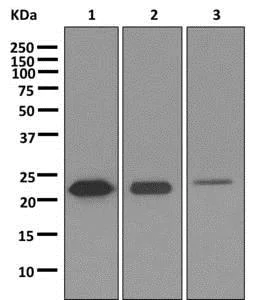 Western blot - Anti-SP17 antibody [EP6496] (AB172626)