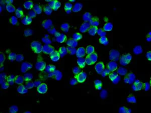 Immunocytochemistry/ Immunofluorescence - Anti-SP17 antibody [EP6496] - BSA and Azide free (AB245780)