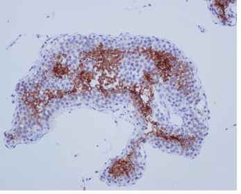 Immunohistochemistry (Formalin/PFA-fixed paraffin-embedded sections) - Anti-SP17 antibody [EPR6497(2)] (AB181079)
