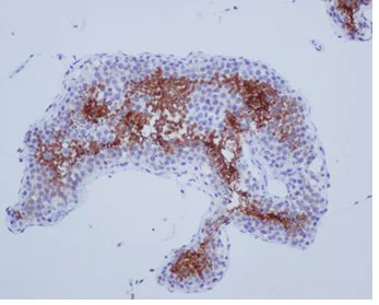Immunohistochemistry (Formalin/PFA-fixed paraffin-embedded sections) - Anti-SP17 antibody [EPR6497(2)] - BSA and Azide free (AB250329)