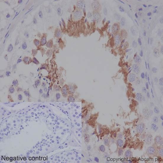 Immunohistochemistry (Formalin/PFA-fixed paraffin-embedded sections) - Anti-SP17 antibody [EPR6497(2)] - BSA and Azide free (AB250329), expandable thumbnail