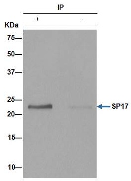 Immunoprecipitation - Anti-SP17 antibody [EPR6497(2)] - BSA and Azide free (AB250329), expandable thumbnail