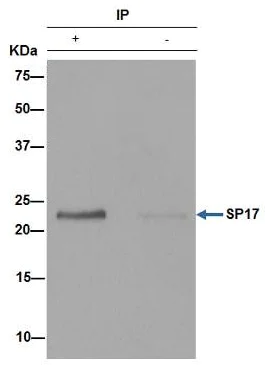 Immunoprecipitation - Anti-SP17 antibody [EPR6497(2)] - BSA and Azide free (AB250329)