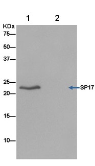 Immunoprecipitation - Anti-SP17 antibody [EPR6497(2)] - BSA and Azide free (AB250329), expandable thumbnail