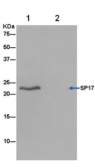 Immunoprecipitation - Anti-SP17 antibody [EPR6497(2)] - BSA and Azide free (AB250329)