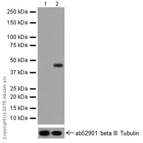 Western blot - Anti-Sp5 antibody [EPR11367(2)] (AB209385), expandable thumbnail