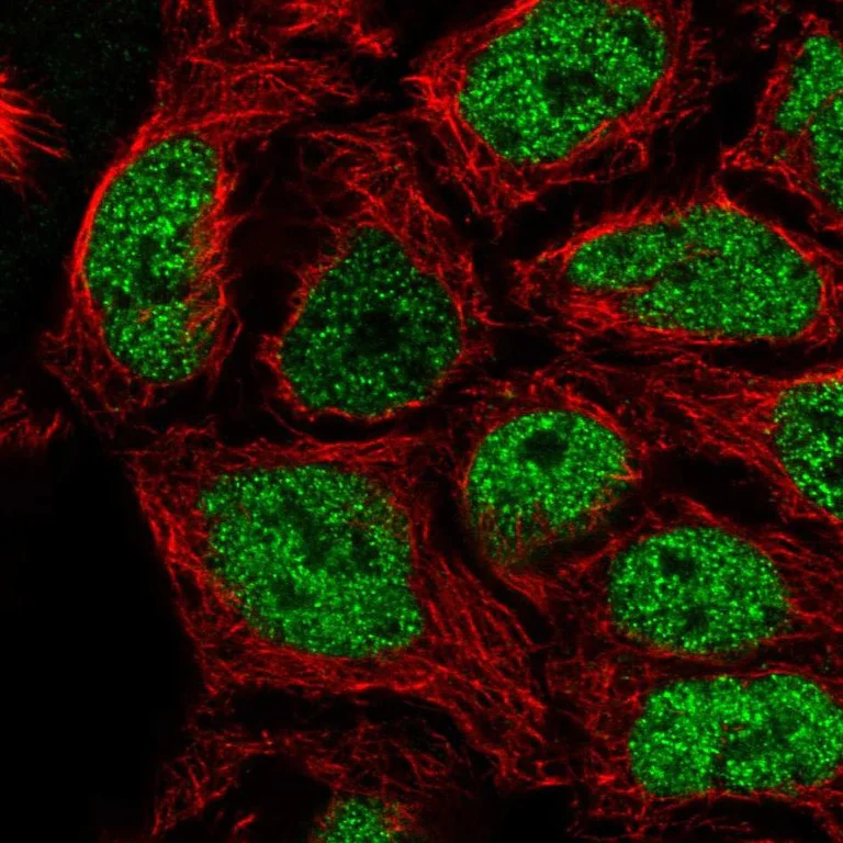 Immunocytochemistry/ Immunofluorescence - Anti-SP6 antibody (AB246952)
