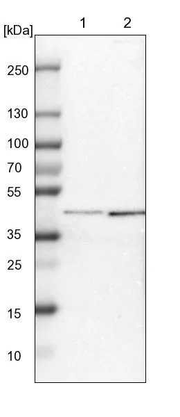 Western blot - Anti-SP6 antibody (AB246952)