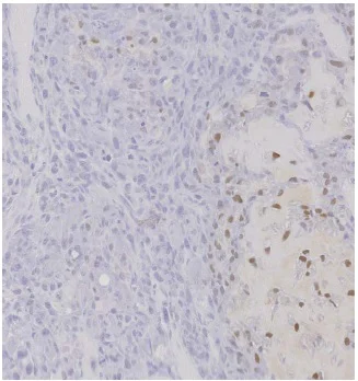 Immunohistochemistry (Formalin/PFA-fixed paraffin-embedded sections) - Anti-Sp7 / Osterix antibody (AB22552)