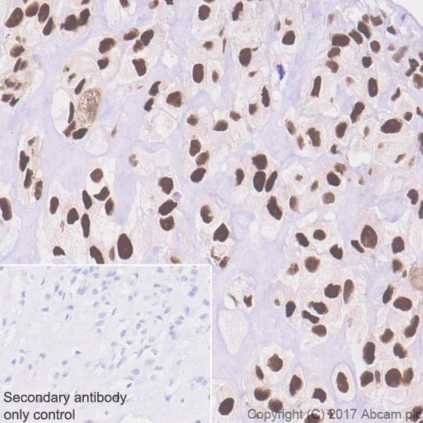 Immunohistochemistry (Formalin/PFA-fixed paraffin-embedded sections) - Anti-Sp7 / Osterix antibody [EPR21034] (AB209484)