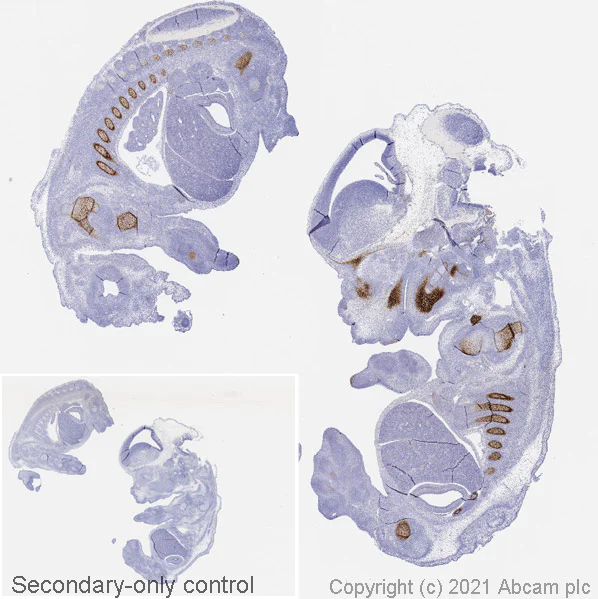 Anti-Sp7 / Osterix antibody [EPR21034] (ab209484) | Abcam