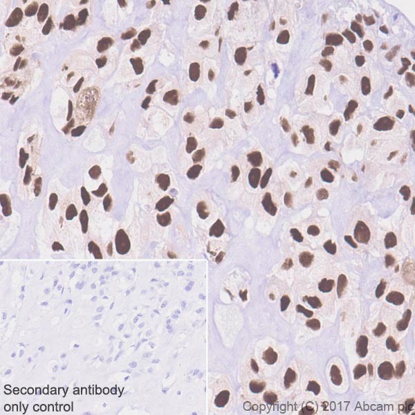 Immunohistochemistry (Formalin/PFA-fixed paraffin-embedded sections) - Anti-Sp7 / Osterix antibody [EPR21034] - BSA and Azide free (AB227820), expandable thumbnail