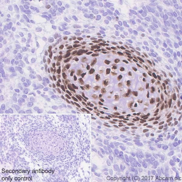 Immunohistochemistry (Formalin/PFA-fixed paraffin-embedded sections) - Anti-Sp7 / Osterix antibody [EPR21034] - BSA and Azide free (AB227820), expandable thumbnail