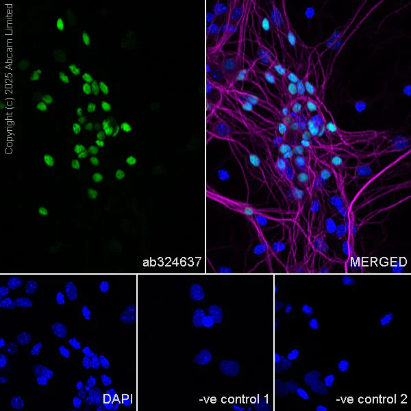 Immunocytochemistry/ Immunofluorescence - Anti-Sp8 antibody [EPR29574-561] (AB324637)