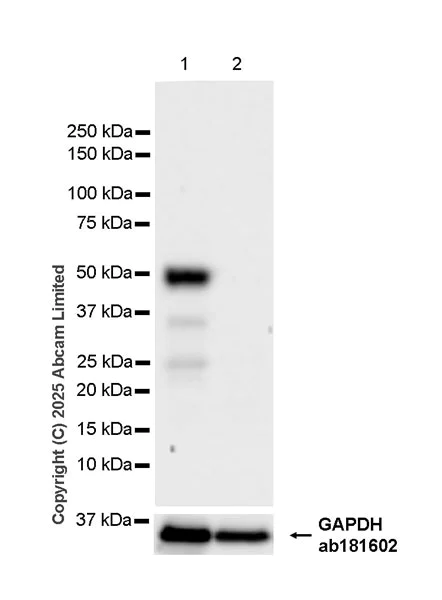 Western blot - Anti-Sp8 antibody [EPR29574-561] (AB324637)