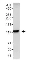 Immunoprecipitation - Anti-Spa-1 antibody (AB85928)