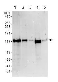 Western blot - Anti-Spa-1 antibody (AB85928)