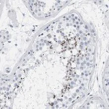 Immunohistochemistry (Formalin/PFA-fixed paraffin-embedded sections) - Anti-SPACA3 antibody (AB121768)