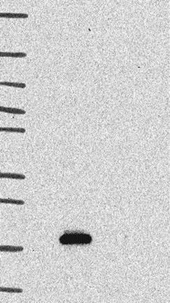 Western blot - Anti-SPACA3 antibody (AB121768)