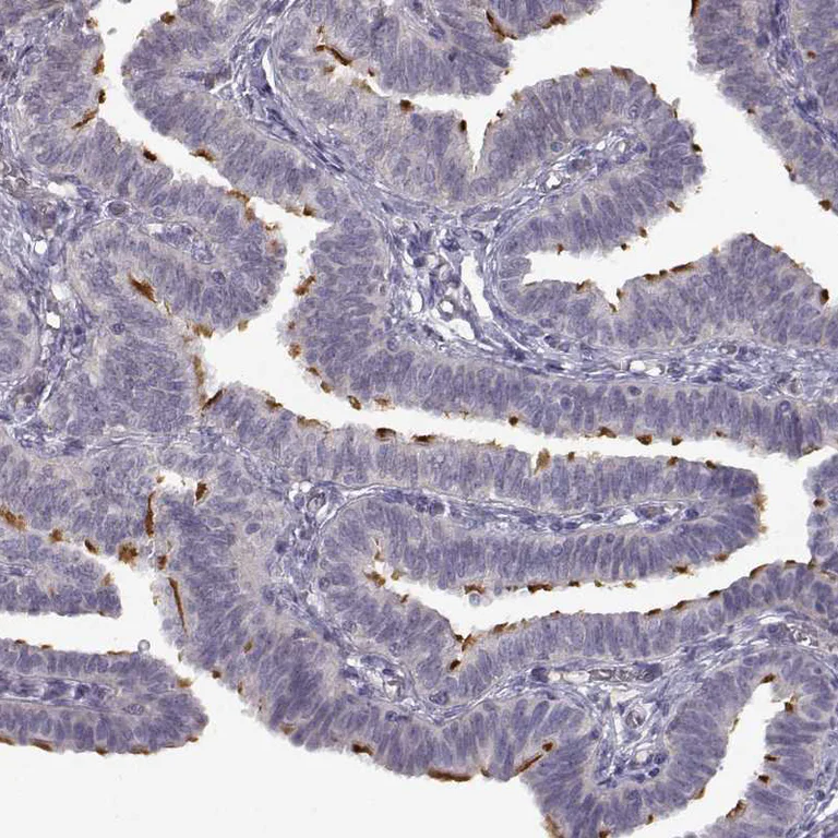 Immunohistochemistry (Formalin/PFA-fixed paraffin-embedded sections) - Anti-SPAG17 antibody (AB122008)