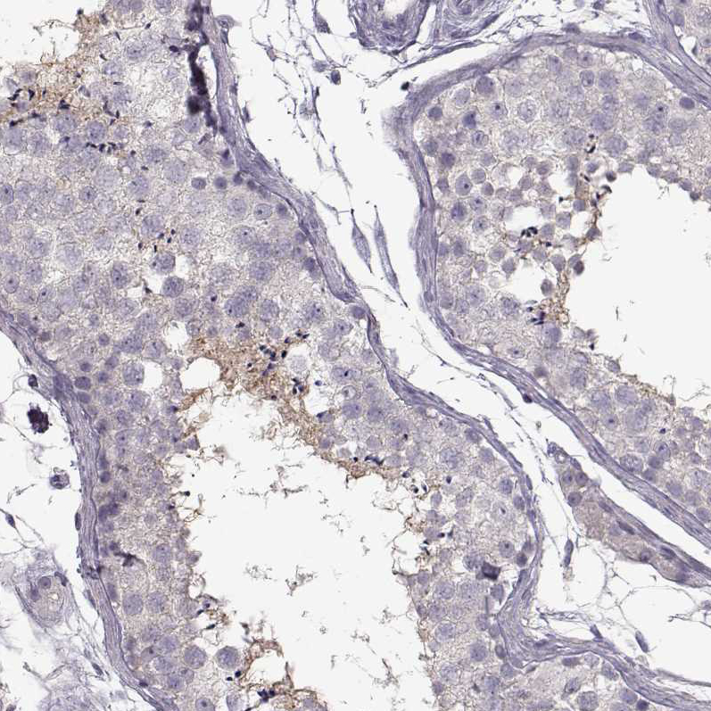 Immunohistochemistry (Formalin/PFA-fixed paraffin-embedded sections) - Anti-SPAG17 antibody (AB122008)