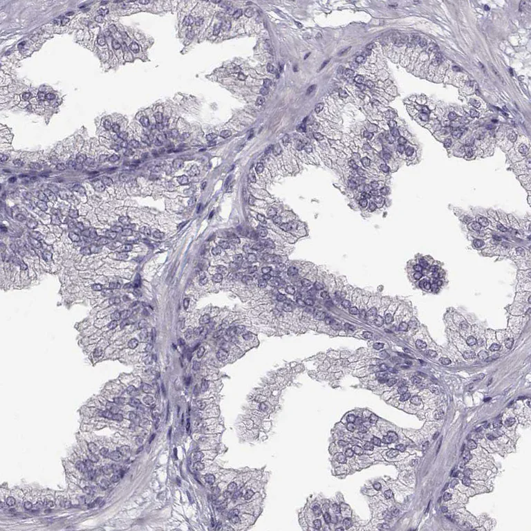 Immunohistochemistry (Formalin/PFA-fixed paraffin-embedded sections) - Anti-SPAG17 antibody (AB122008)