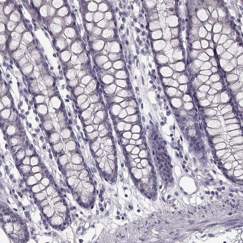 Immunohistochemistry (Formalin/PFA-fixed paraffin-embedded sections) - Anti-SPAG17 antibody (AB122008)