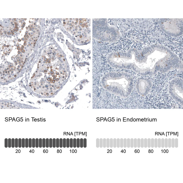Immunohistochemistry (Formalin/PFA-fixed paraffin-embedded sections) - Anti-SPAG5 Antibody [CL10078] (AB327130)