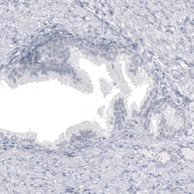 Immunohistochemistry (Formalin/PFA-fixed paraffin-embedded sections) - Anti-SPAG5 Antibody [CL10078] (AB327130)
