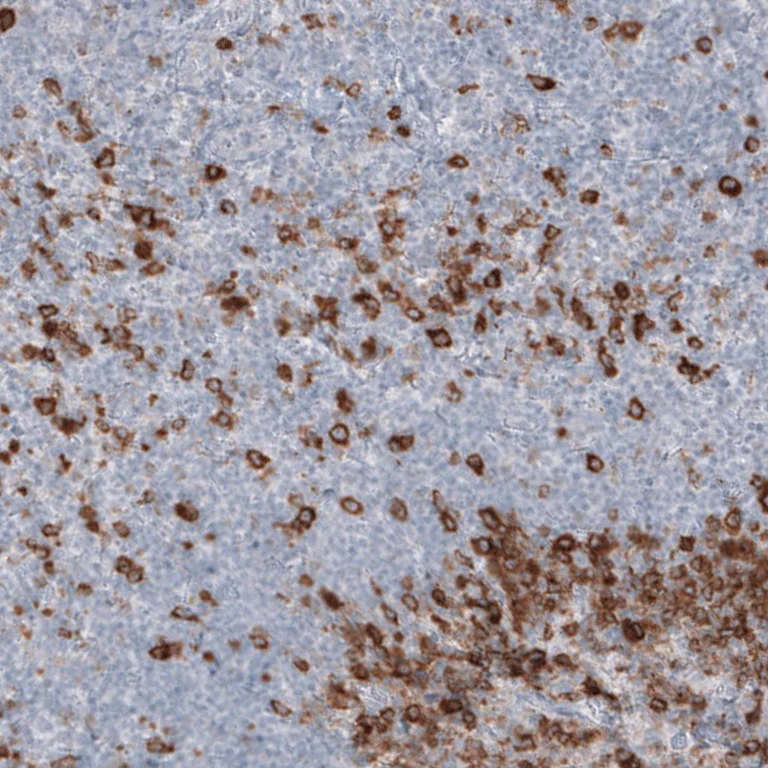 Immunohistochemistry (Formalin/PFA-fixed paraffin-embedded sections) - Anti-SPAG5 Antibody [CL10078] (AB327130)