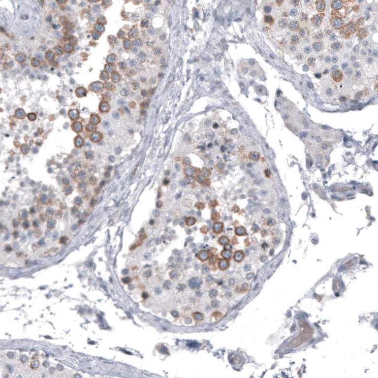 Immunohistochemistry (Formalin/PFA-fixed paraffin-embedded sections) - Anti-SPAG5 Antibody [CL10078] (AB327130)