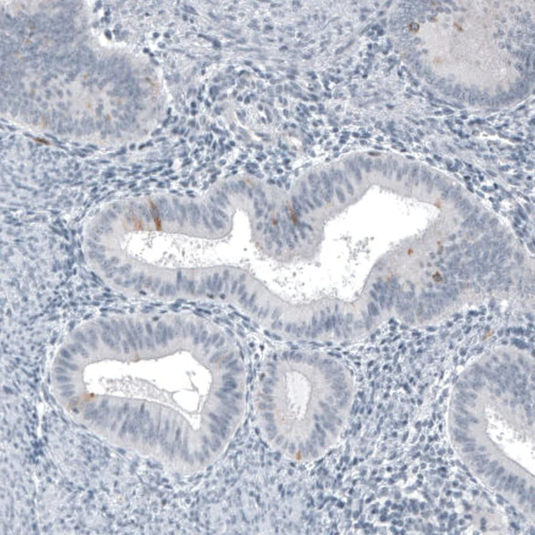 Immunohistochemistry (Formalin/PFA-fixed paraffin-embedded sections) - Anti-SPAG5 Antibody [CL10078] (AB327130)