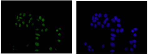 Immunocytochemistry/ Immunofluorescence - Anti-SPAG7 antibody [EPR13391] (AB181187)