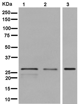 Western blot - Anti-SPAG7 antibody [EPR13391] (AB181187)
