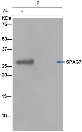 Immunoprecipitation - Anti-SPAG7 antibody [EPR13391] - BSA and Azide free (AB250412)