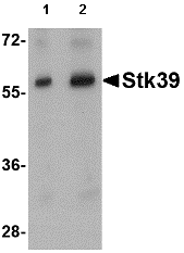 Western blot - Anti-SPAK antibody (AB79045)