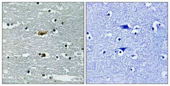 Immunohistochemistry (Formalin/PFA-fixed paraffin-embedded sections) - Anti-SPAK (phospho S309) antibody (AB192798), expandable thumbnail
