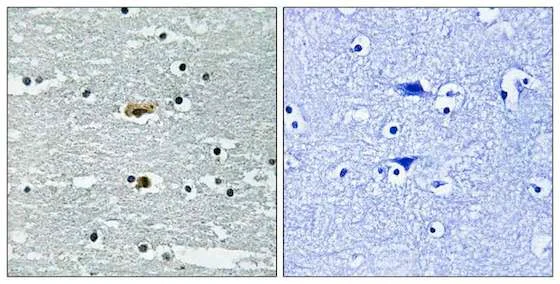 Immunohistochemistry (Formalin/PFA-fixed paraffin-embedded sections) - Anti-SPAK (phospho S309) antibody (AB192798)