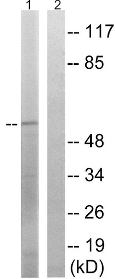 Western blot - Anti-SPAK (phospho S309) antibody (AB192798), expandable thumbnail