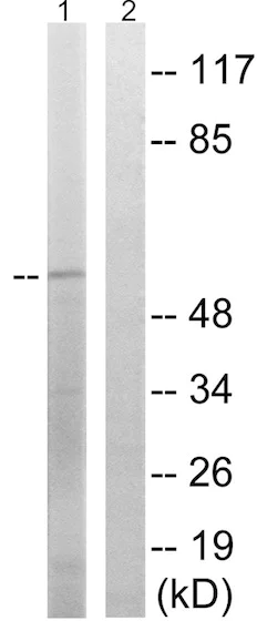 Western blot - Anti-SPAK (phospho S309) antibody (AB192798)